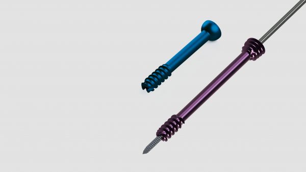 Kompressionsschraubensystem